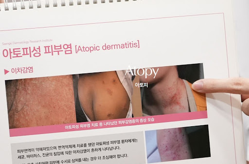 생기한의원이 설명하는 아토피 악화 요인과 생활 자극 정보